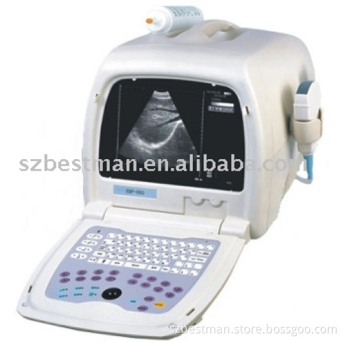(Super Deal) Ultrasound Scanner